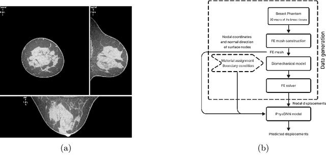 Figure 1 for Graph Neural Networks for modelling breast biomechanical compression