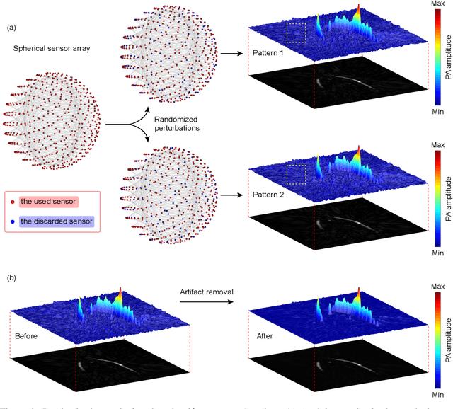 Figure 1 for Zero-Shot Artifact2Artifact: Self-incentive artifact removal for photoacoustic imaging without any data