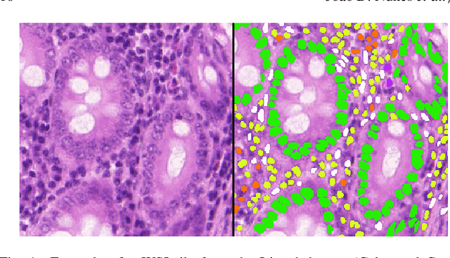 Figure 2 for A Survey on Cell Nuclei Instance Segmentation and Classification: Leveraging Context and Attention