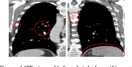 Figure 1 for A Probabilistic Approach to Learning the Degree of Equivariance in Steerable CNNs