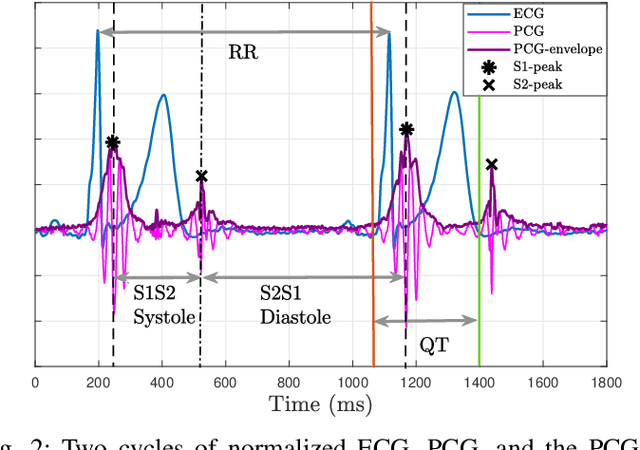 Figure 3 for Electromechanical Dynamics of the Heart: A Study of Cardiac Hysteresis During Physical Stress Test