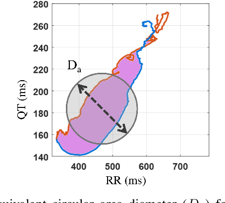 Figure 4 for Electromechanical Dynamics of the Heart: A Study of Cardiac Hysteresis During Physical Stress Test