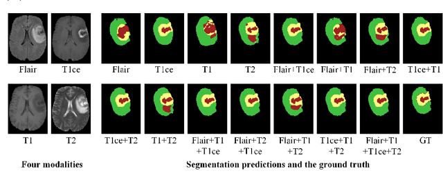 Figure 4 for A Multimodal Feature Distillation with CNN-Transformer Network for Brain Tumor Segmentation with Incomplete Modalities