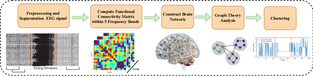 Figure 1 for Dynamic Changes of Brain Network during Epileptic Seizure