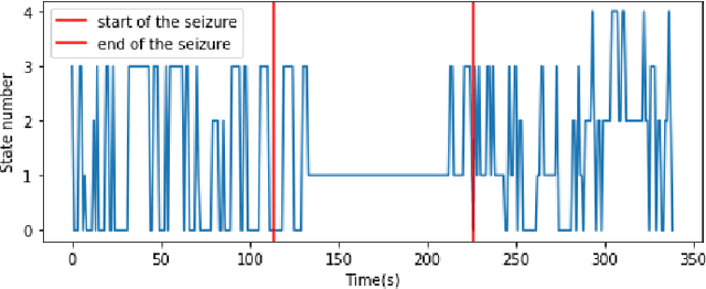 Figure 4 for Dynamic Changes of Brain Network during Epileptic Seizure