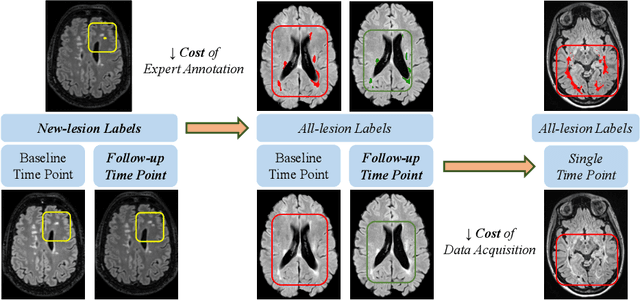 Figure 1 for CoactSeg: Learning from Heterogeneous Data for New Multiple Sclerosis Lesion Segmentation