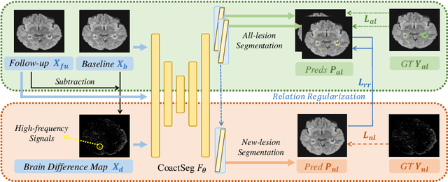 Figure 3 for CoactSeg: Learning from Heterogeneous Data for New Multiple Sclerosis Lesion Segmentation