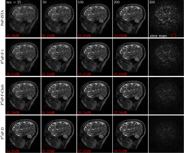 Figure 4 for Provable Preconditioned Plug-and-Play Approach for Compressed Sensing MRI Reconstruction