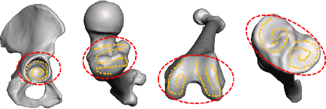 Figure 3 for Partial-to-Full Registration based on Gradient-SDF for Computer-Assisted Orthopedic Surgery