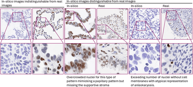 Figure 4 for Mask-guided cross-image attention for zero-shot in-silico histopathologic image generation with a diffusion model