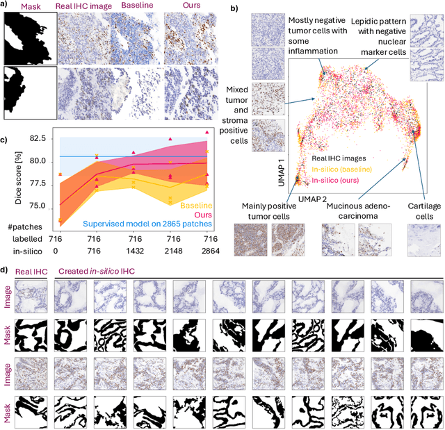 Figure 2 for Mask-guided cross-image attention for zero-shot in-silico histopathologic image generation with a diffusion model