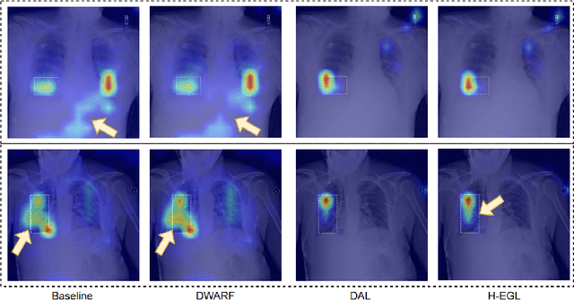 Figure 3 for Hybrid Explanation-Guided Learning for Transformer-Based Chest X-Ray Diagnosis
