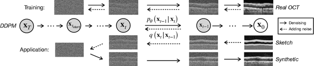 Figure 1 for Retinal OCT Synthesis with Denoising Diffusion Probabilistic Models for Layer Segmentation