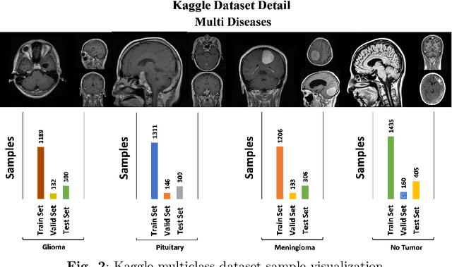 Figure 3 for Robust & Precise Knowledge Distillation-based Novel Context-Aware Predictor for Disease Detection in Brain and Gastrointestinal