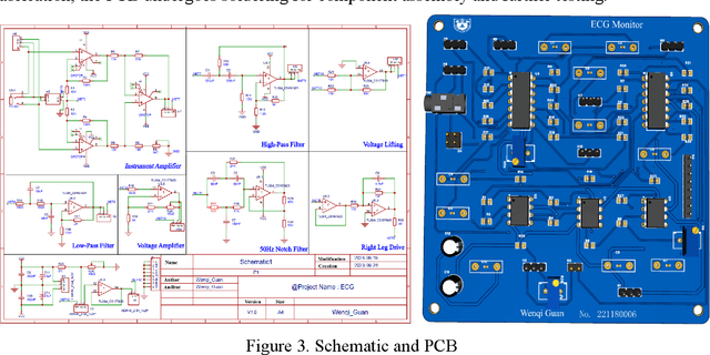 Figure 4 for An Electrocardiogram Monitoring Device Based on STM32