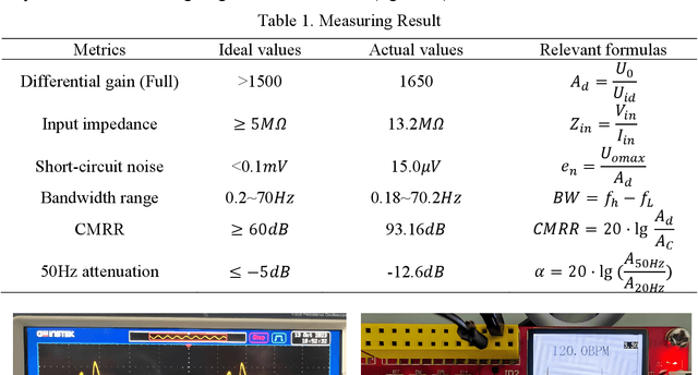 Figure 2 for An Electrocardiogram Monitoring Device Based on STM32