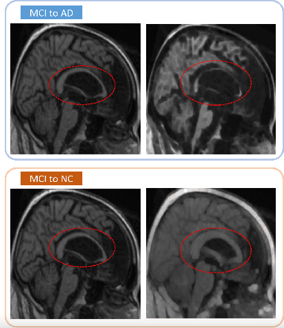 Figure 1 for DS-ViT: Dual-Stream Vision Transformer for Cross-Task Distillation in Alzheimer's Early Diagnosis