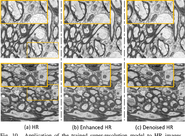 Figure 2 for No-Clean-Reference Image Super-Resolution: Application to Electron Microscopy