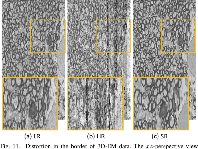 Figure 3 for No-Clean-Reference Image Super-Resolution: Application to Electron Microscopy