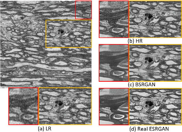 Figure 4 for No-Clean-Reference Image Super-Resolution: Application to Electron Microscopy