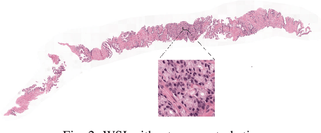 Figure 2 for Adversary-Robust Graph-Based Learning of WSIs