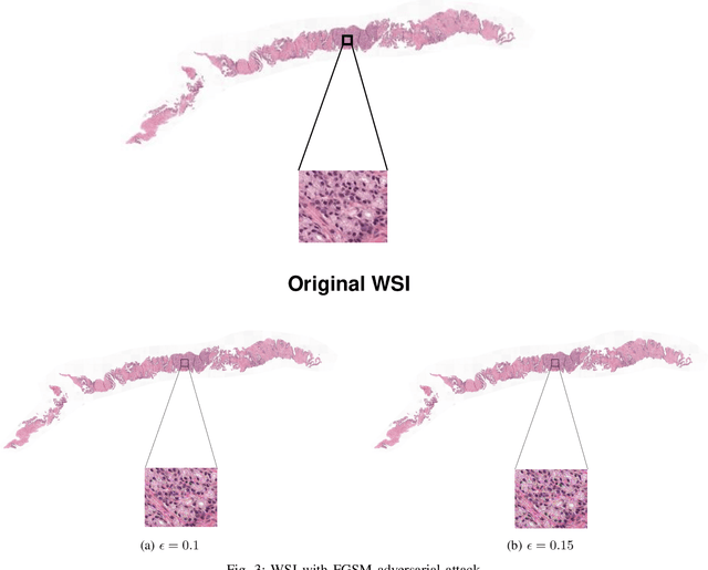 Figure 3 for Adversary-Robust Graph-Based Learning of WSIs