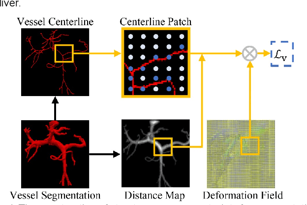 Figure 4 for Structure-aware registration network for liver DCE-CT images