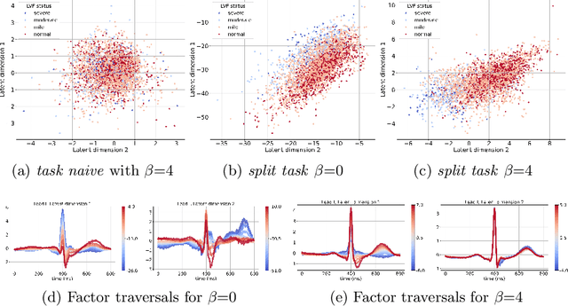 Figure 4 for Joint optimization of a $β$-VAE for ECG task-specific feature extraction