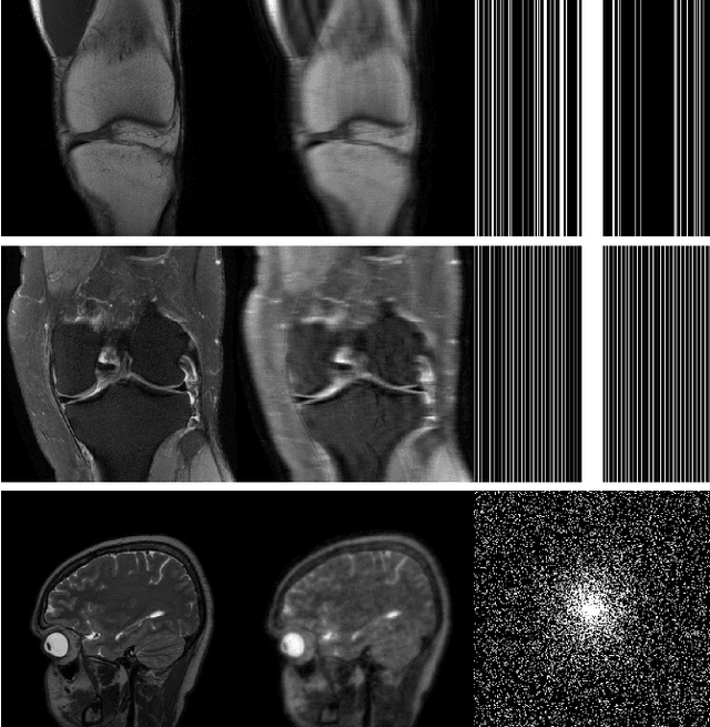 Figure 3 for A Collaborative Model-driven Network for MRI Reconstruction