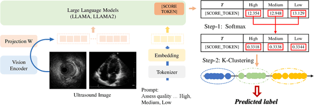 Figure 4 for Ultrasound-QBench: Can LLMs Aid in Quality Assessment of Ultrasound Imaging?