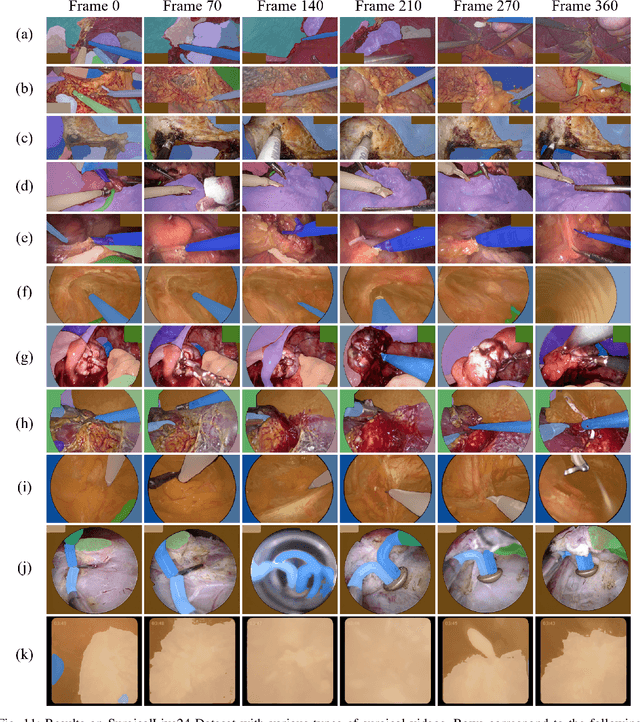 Figure 3 for Is Segment Anything Model 2 All You Need for Surgery Video Segmentation? A Systematic Evaluation