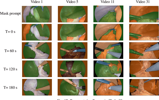 Figure 4 for Is Segment Anything Model 2 All You Need for Surgery Video Segmentation? A Systematic Evaluation