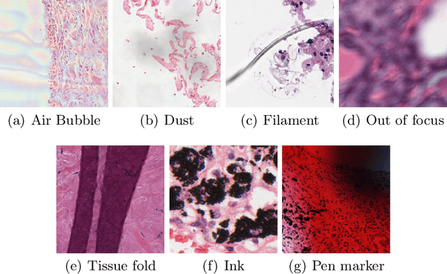 Figure 4 for Artifact Removal in Histopathology Images