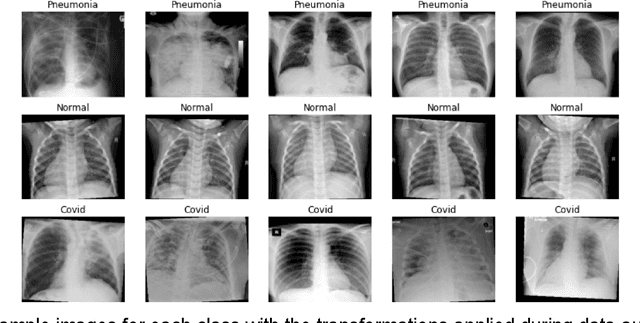 Figure 1 for Comparison of Neural Models for X-ray Image Classification in COVID-19 Detection