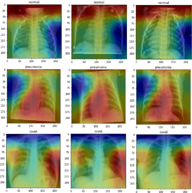 Figure 2 for Comparison of Neural Models for X-ray Image Classification in COVID-19 Detection