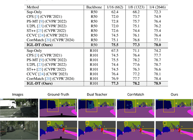 Figure 2 for IGL-DT: Iterative Global-Local Feature Learning with Dual-Teacher Semantic Segmentation Framework under Limited Annotation Scheme