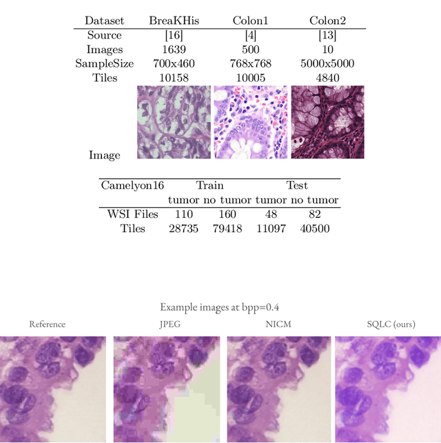 Figure 4 for Learned Image Compression for HE-stained Histopathological Images via Stain Deconvolution