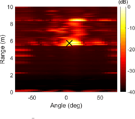 Figure 3 for Radar-Based Respiratory Measurement of a Rhesus Monkey by Suppressing Nonperiodic Body Motion Components