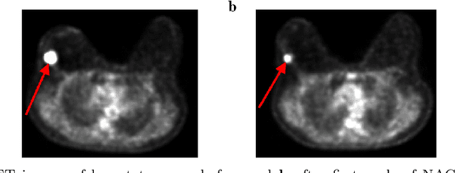 Figure 3 for Automatic quantification of breast cancer biomarkers from multiple 18F-FDG PET image segmentation