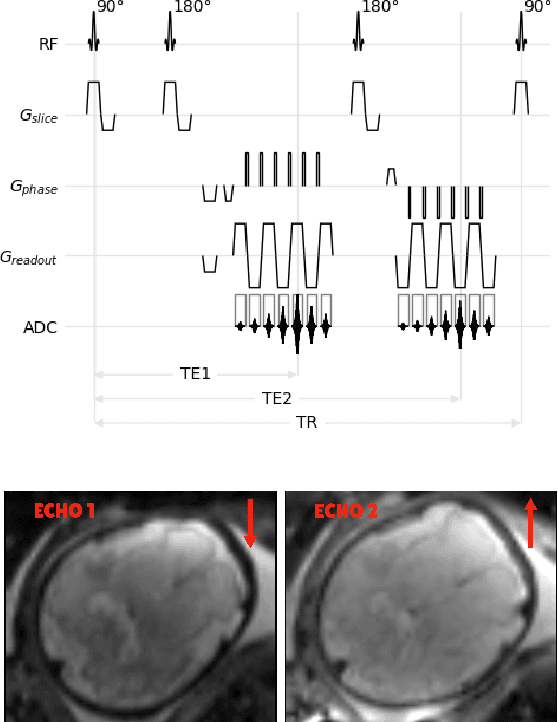 Figure 3 for HAITCH: A Framework for Distortion and Motion Correction in Fetal Multi-Shell Diffusion-Weighted MRI