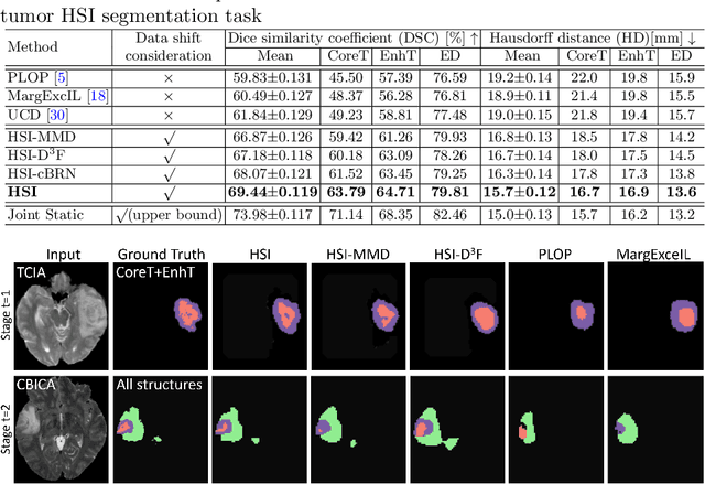 Figure 2 for Incremental Learning for Heterogeneous Structure Segmentation in Brain Tumor MRI