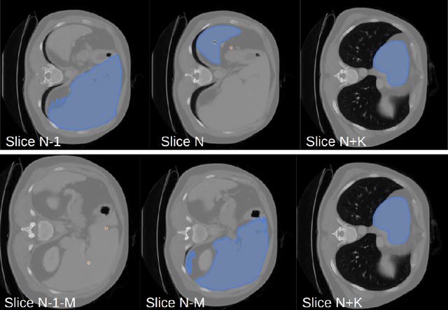 Figure 1 for A Short Review and Evaluation of SAM2's Performance in 3D CT Image Segmentation