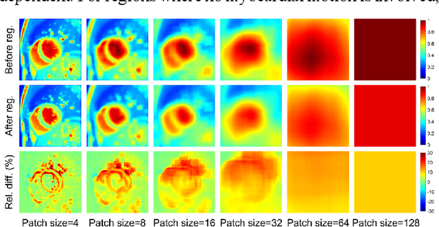 Figure 1 for Deformable Groupwise Registration Using a Locally Low-Rank Dissimilarity Metric for Myocardial Strain Estimation from Cardiac Cine MRI Images