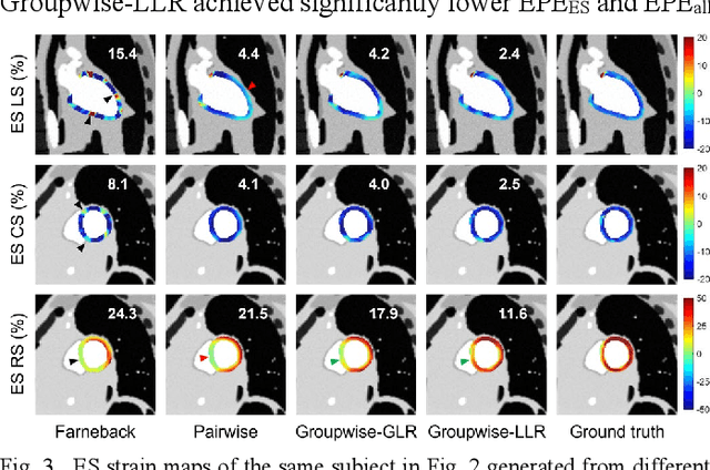 Figure 3 for Deformable Groupwise Registration Using a Locally Low-Rank Dissimilarity Metric for Myocardial Strain Estimation from Cardiac Cine MRI Images