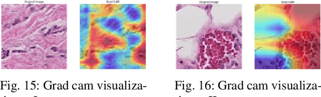 Figure 4 for Enhancing GANs with Contrastive Learning-Based Multistage Progressive Finetuning SNN and RL-Based External Optimization