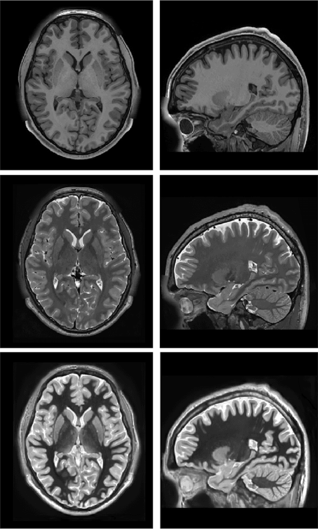 Figure 1 for Ultra-high resolution multimodal MRI dense labelled holistic brain atlas