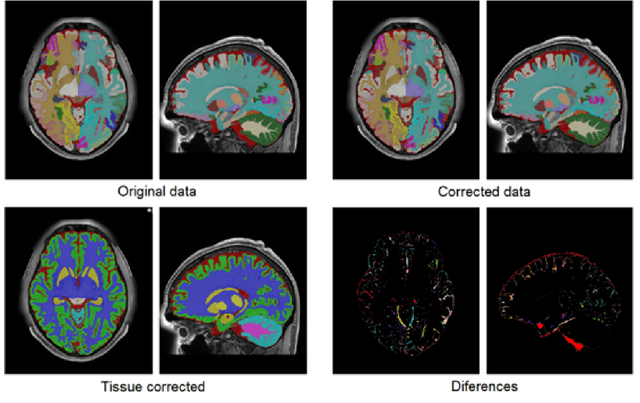 Figure 2 for Ultra-high resolution multimodal MRI dense labelled holistic brain atlas