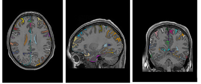 Figure 3 for Ultra-high resolution multimodal MRI dense labelled holistic brain atlas