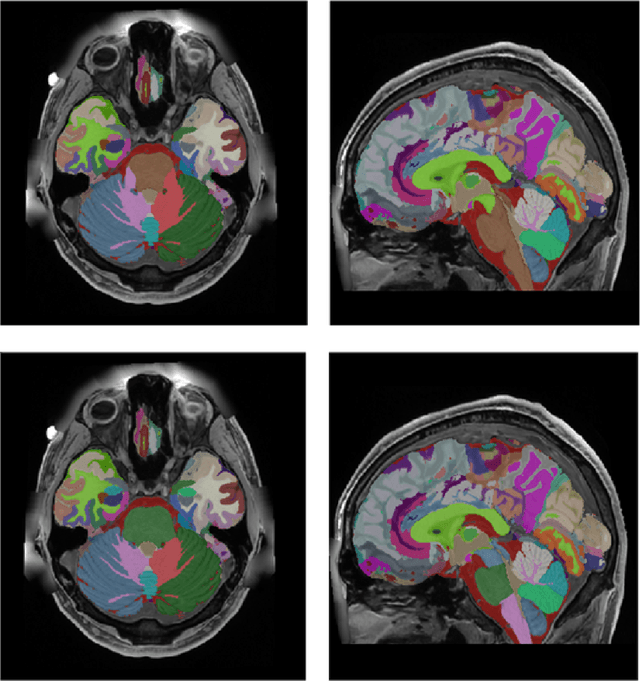 Figure 4 for Ultra-high resolution multimodal MRI dense labelled holistic brain atlas