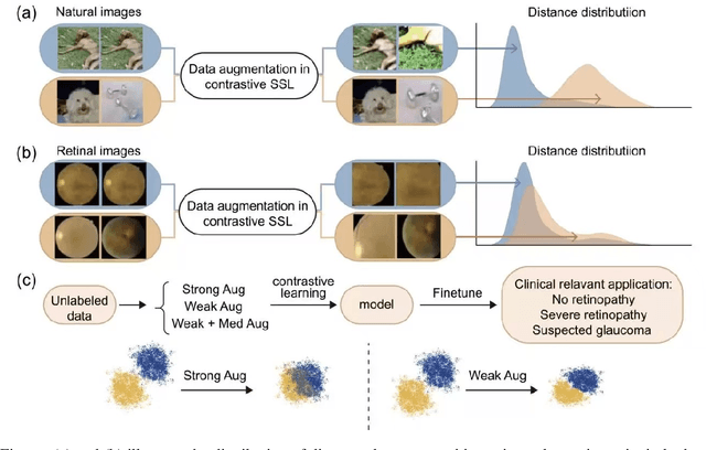 Figure 1 for Enhancing Contrastive Learning for Retinal Imaging via Adjusted Augmentation Scales